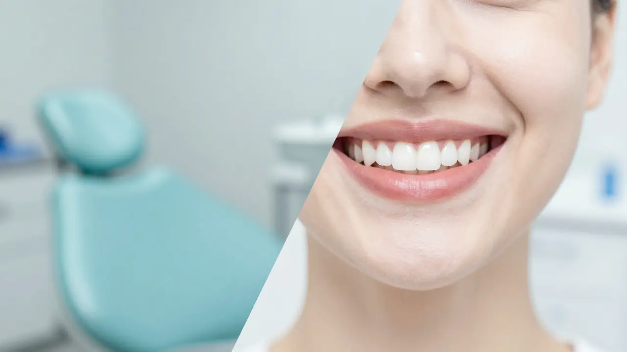 Konceptuální zobrazení čistého a zdravého úsměvu po profesionálním čištění.